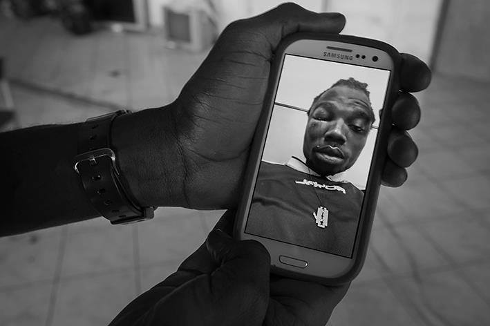 Una foto di Mustafà, rifugiato del Gambia, dopo lo sgombero. Credit: Danilo Balducci